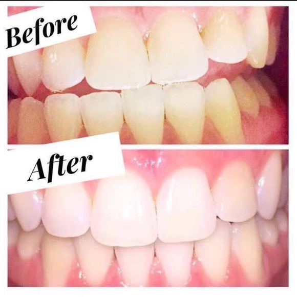 AP24 whitening toothpaste - Picture 5 of 7